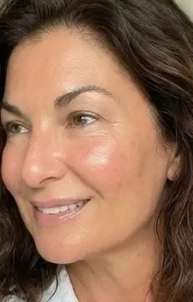 אחרי